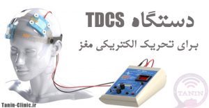 tDCS برای تحریک الکتریکی مغز
