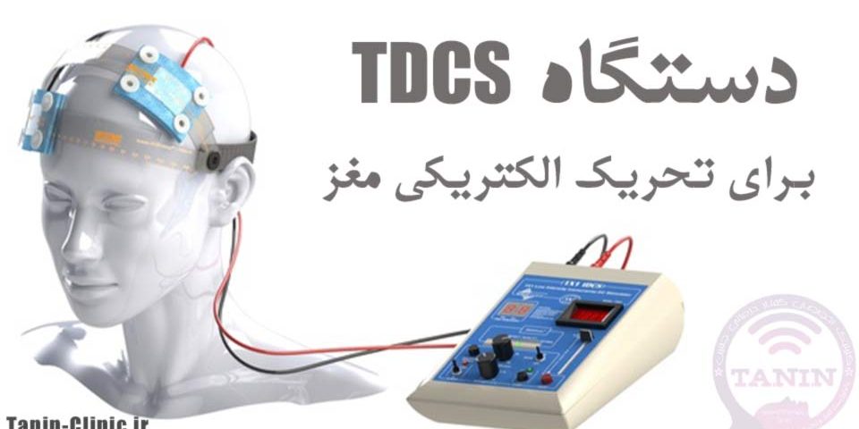 TDCS برای تحریک الکتریکی مغز