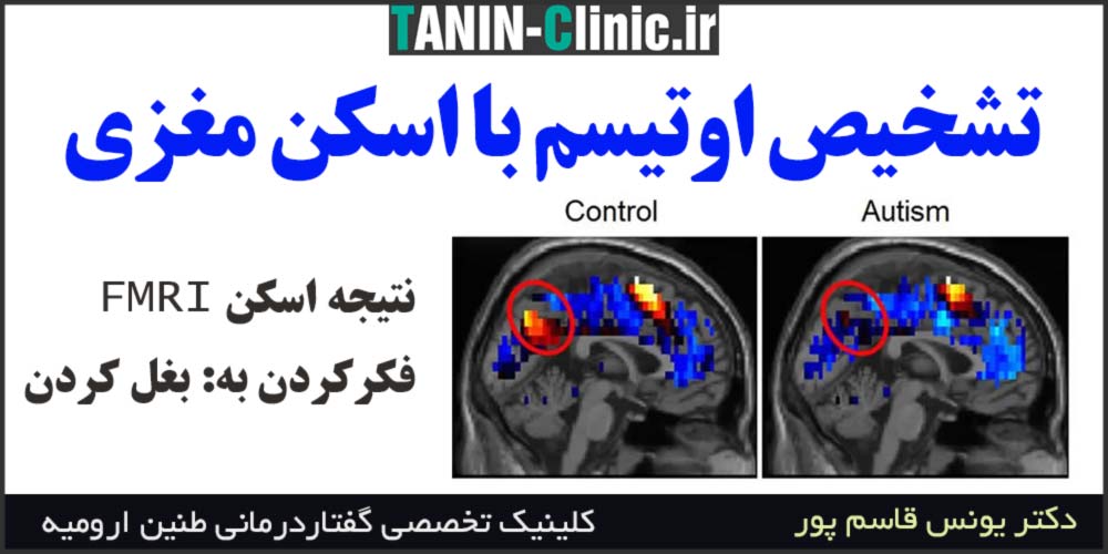 تشخیص اوتیسم با اسکن مغزی FMRI